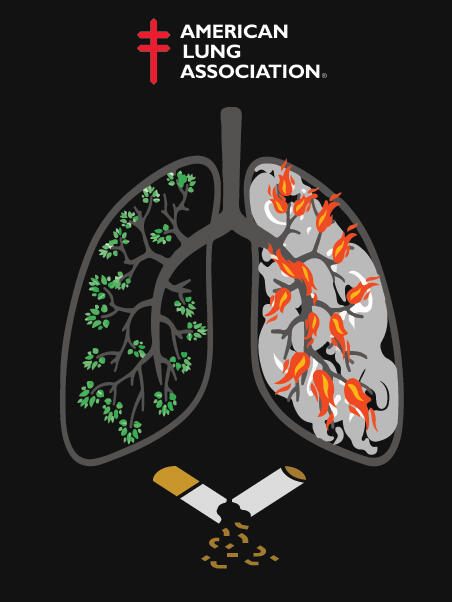 American Lung Association poster